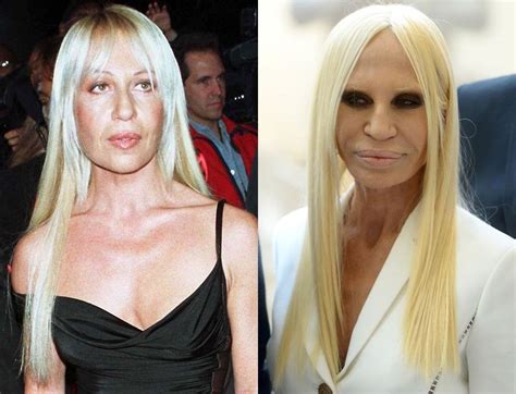 donatella versace inglese|donatella versace before and after.